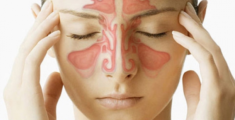 Sinusite : Symptômes, causes et Traitement